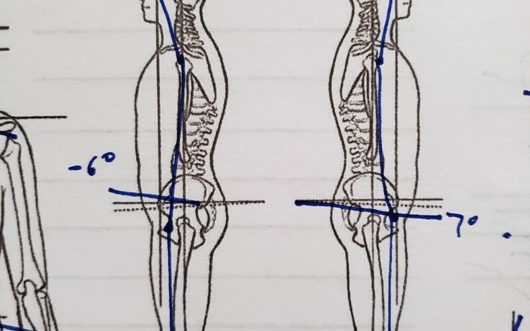 PATIENT SUCCESS STORY: Hips Don’t Lie